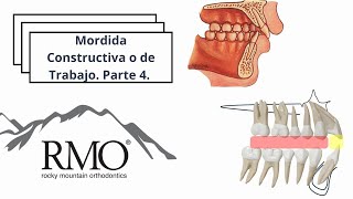 Mordida Constructiva o de Trabajo Parte 4 [upl. by Serrell]