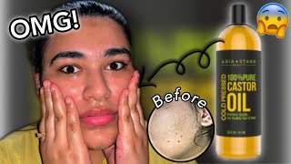 I Used CASTOR OIL On My Skin Everyday For 5 Days amp This Is What Happened [upl. by Sirron166]