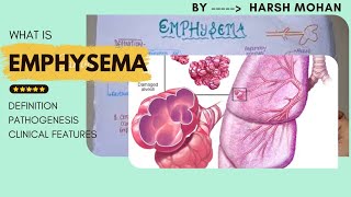 What is Emphysema Types of COPD and the Pathology of Lung Disease [upl. by Eiramadnil943]