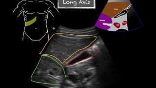 POCUS  Gallbladder Ultrasound Anatomy [upl. by Fisken]