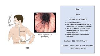 An Approach to GI Bleeding Melena Hematemesis Hematochezia [upl. by Kacie]