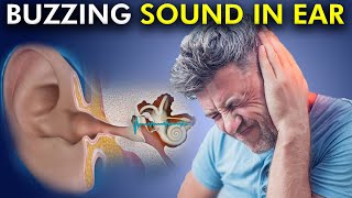 Tinnitus Annoying sound in Ear Causes and Treatments strategies [upl. by Attela]