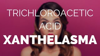 Trichloroacetic acid xanthelasma does it work [upl. by Lertnek259]