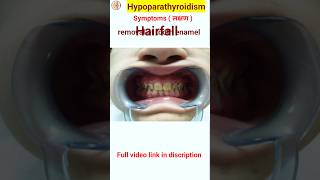 Hypoparathyroidism symptoms in hindi  shorts shortsfeeds [upl. by Ok]