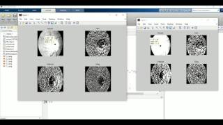 Retina Image Segmentation With Wavelet Transform From Scratch Matlab Code [upl. by Jennifer]