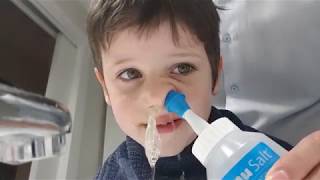 Cómo limpiar la sinusitis a un niño [upl. by Hazem]