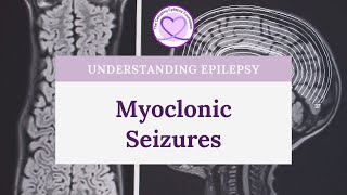 What are Myoclonic Seizures [upl. by Eeneg]