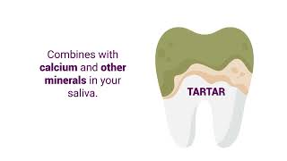 Plaque vs Tartar [upl. by Upali]