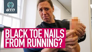 How To Stop Getting Black Toenails From Running [upl. by Leela]