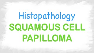 Squamous cell papilloma histopathology features [upl. by Sutit220]