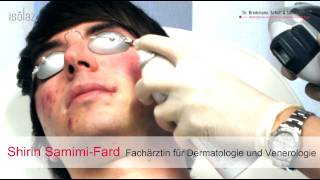 AKNE LIVEBEHANDLUNG  Isolaz und Fraxel Laser  DERMA LOFT Gladbeck [upl. by Thoma]