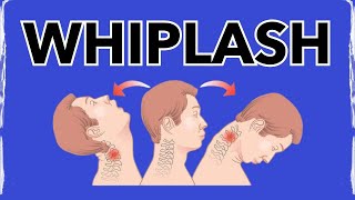 Whiplash A Physical Therapy SECRET for Treating [upl. by Ettelrac727]