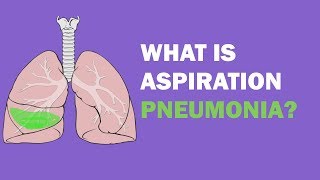 What is aspiration pneumonia [upl. by Tutt495]