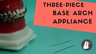 Three Piece Base Arch Appliance  Essential Biomechanics [upl. by Michale]