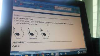 ICD10 JJ10A36310L0 urachal cyst patent urachus [upl. by Gnat]