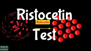 Ristocetin Test  Ristocetin Assay  Ristocetininduced Platelet Aggregation  RIPA [upl. by Guglielma]