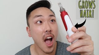 PROOF MICRONEEDLING BY ITSELF WORKS FOR HAIR LOSS [upl. by Goren360]