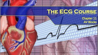 The ECG Course  AV Blocks [upl. by Thayne]