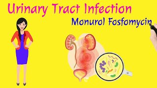 UTI  Monurol 3g Fosfomycin Trometamol  Urinary Tract Infection  UTI  Dr Anil Thakor [upl. by Miculek]