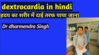 dextrocardia in hindi  congenital heart disease in hindi  dextrocardia baby [upl. by Felise]