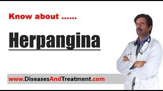 Herpangina  Causes Diagnosis Symptoms Treatment [upl. by Pet25]