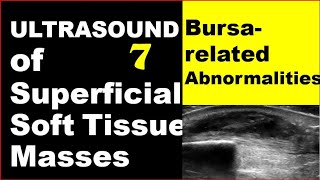 Bursa related abnormalities [upl. by Floria]