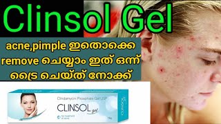 Acne Removal Malayalam  Clinsol Gel  Pimple Remove Malayalamacneremovalmalayalamclinsolgel [upl. by Huppert]