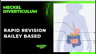 Meckel Diverticulum  Bailey Based  Rapid Revision  neetss2024 surgeryeducation surgeon [upl. by Einwahs828]