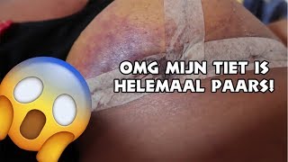 OMG MIJN TIET IS PAARS 😱😱  VONNEKEBONNEKE VLOG 140 [upl. by Naeerb226]