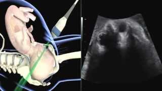 Mechanism of Normal Labour  Practical Explanation  English  Nursing Lecture [upl. by Anifur705]