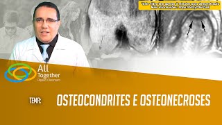 Osteocondrites e Osteonecroses [upl. by Ardel]