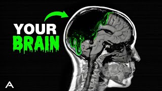 Brain Rot is Far Worse Than You Think [upl. by Olivia923]