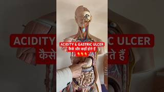 ACIDITY amp GASTRIC ULCER कैसे और कहाँ होते हैं  Digestive System viral shorts trending [upl. by Yerdua]