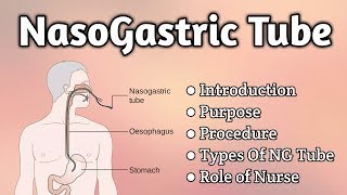 Nasogastric Tube Intubation [upl. by Cleland]