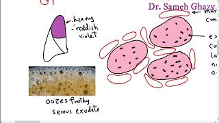 Systemic pathology 13  respiratory system 1  pneumonia and lung abscess DRSAMEH GHAZY [upl. by Pantia25]