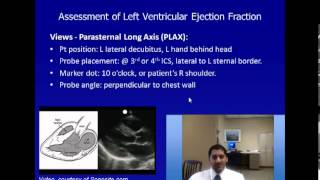 Estimating Ejection Fraction with Point of Care Echo [upl. by Llerrahs]