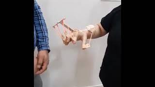 Dynamic Cockup Hand Splint Finger Extension For Paralysis amp Stroke PatientsSalo Orthotics [upl. by Chun]