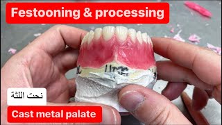 FESTOONING AND PROCESSING AN UPPER DENTURE CAST METAL PALATE waxbae [upl. by Oretna]