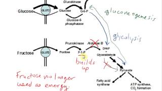 Hereditary Fructose Intolerance HFI [upl. by Nomal]