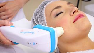 Antiageing facial treatments  Skin Renewal [upl. by Bailar252]