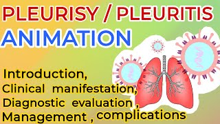 pleurisy  pleuritis  pleurisy symptoms  pleurisy treatment  3d animation  pleuritic chest pain [upl. by Otila]