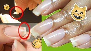 How To Treat Peeling Splitting Brittle  Dry Natural Nails without Soaking or Buffing Them 😻 [upl. by Atteloiv]