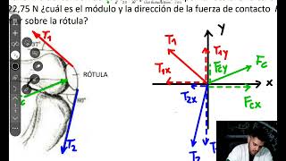 BIOFÍSICA UAX  Problema 5 tema 2  Fuerza de contacto sobre la rótula [upl. by Simone]