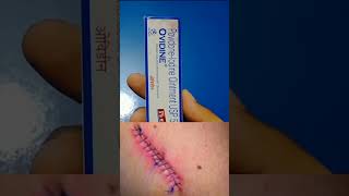 Ovidine Ointment  PovidoneIodine Ointment woundhealing viralvideo ytshorts health shorts [upl. by Anerol]