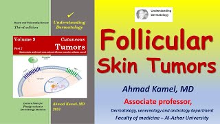 Follicular skin tumors [upl. by Nalyak]