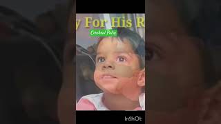 Cerebral Palsy  Kids Disease  Baby Illness babyvideo trending [upl. by Onileba]