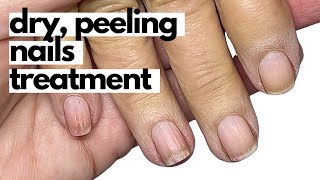 How to effectively condition dry brittle nails Start TODAY [upl. by Brittne]