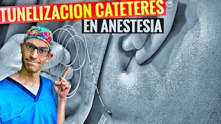 TUNELIZACIÓN DE CATÉTER EN ANESTESIA [upl. by Ahsienel]