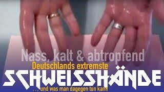 Extreme Schweißhände Handschweiß Sascha Ballweg Hyperhidrose HyperhidrosisPalmaris [upl. by Euqinay]