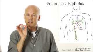 Chest Pain 1 Schema [upl. by Niatirb]